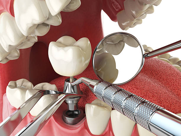 Best Emergency Gum Treatment in East Chicago, IN